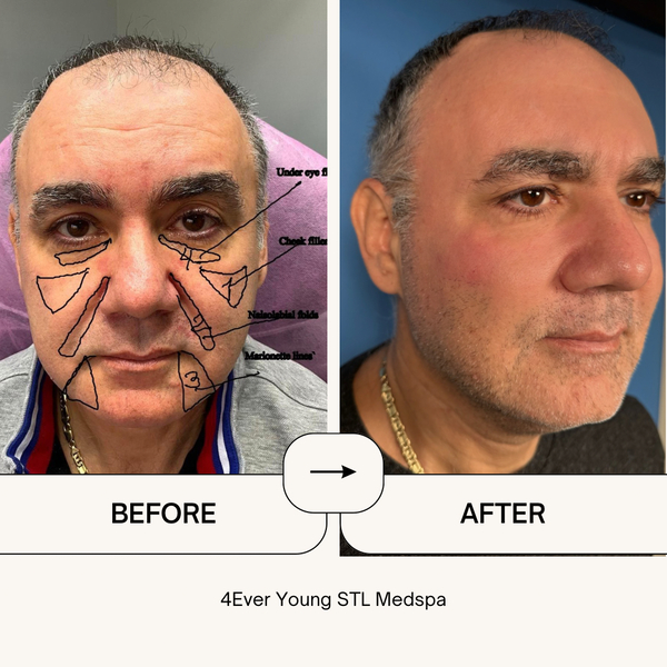 Cover photo of 4Ever Young STL MedSpa